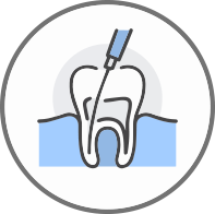 Root Canal